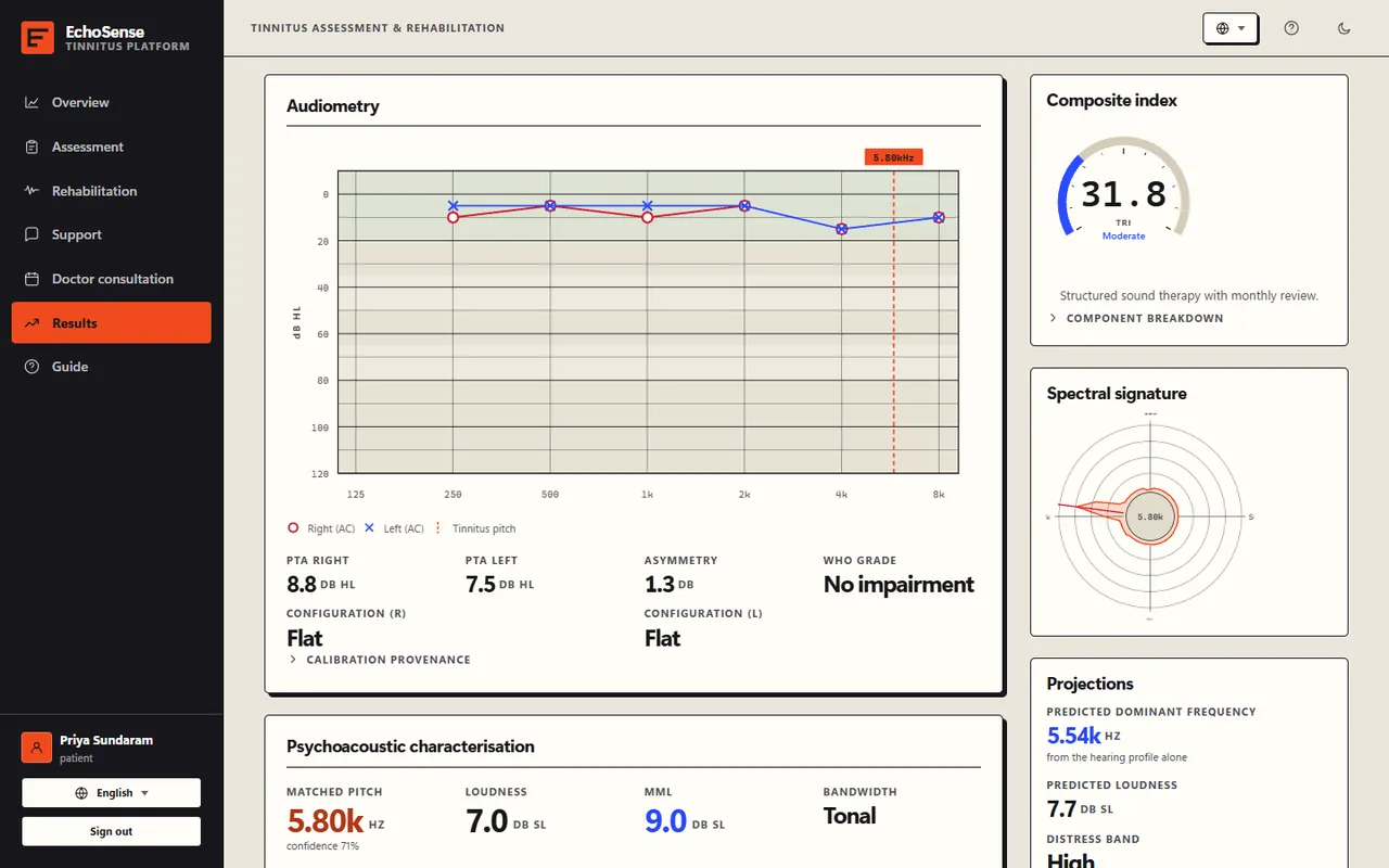 EchoSense clinical report: audiogram with the matched tinnitus pitch, composite index and spectral signature
